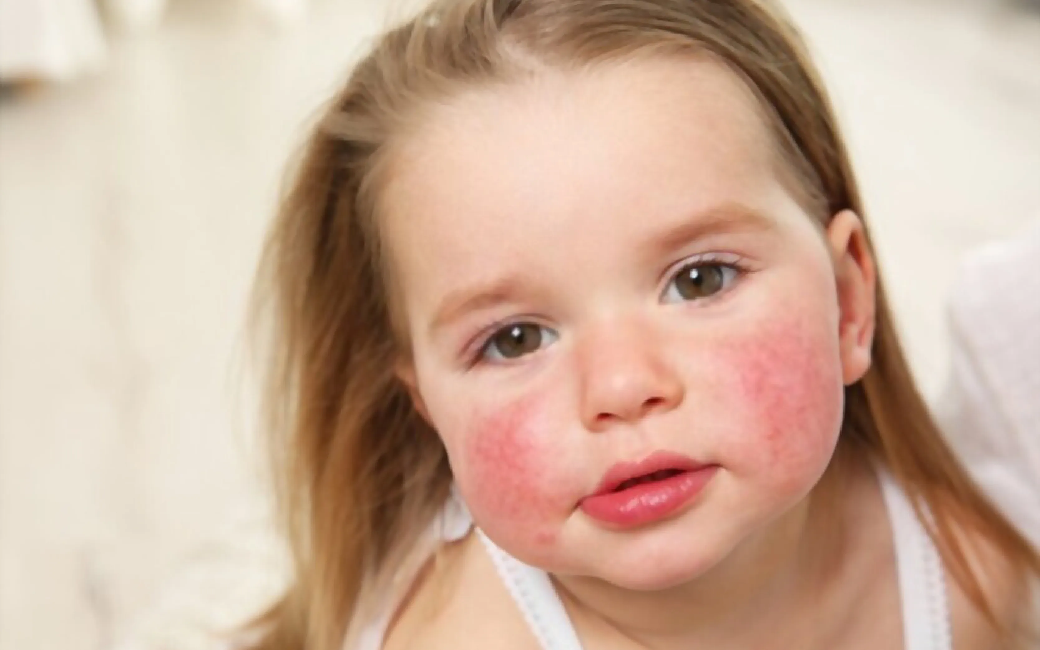 carpet cleaners in Brooklyn, carpet cleaning in Brooklyn, carpet cleaning bkln, carpet cleaners in brooklyn,  commercial carpet cleaning, commercial carpet cleaning in brooklyn,carpet cleaning in brooklyn,  brooklyn rug cleaners, rug cleaning services in brooklyn, same day carpet cleaning, same day rug cleaning